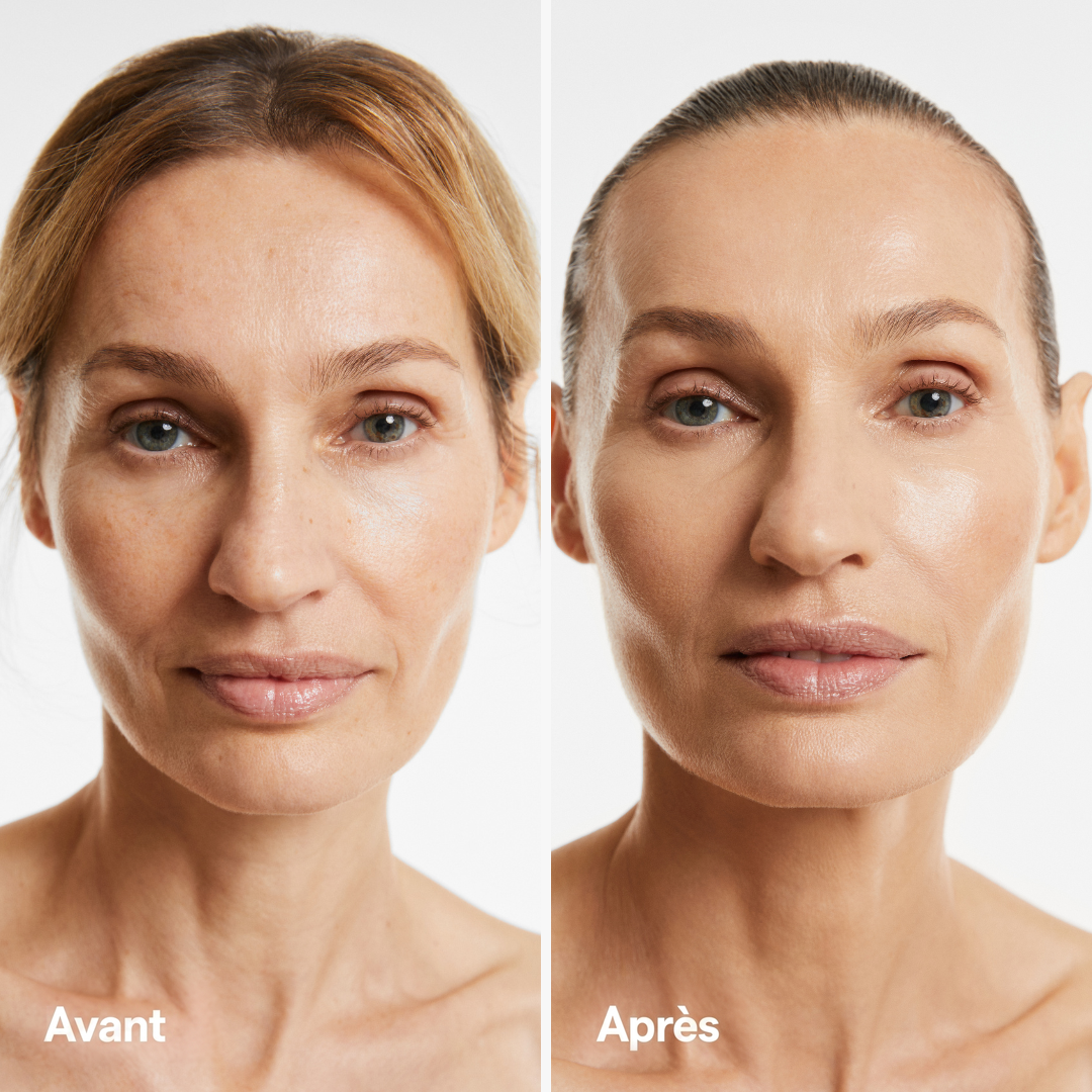 Fond de Teint Adaptatif — avant / après peau mature | Smooche